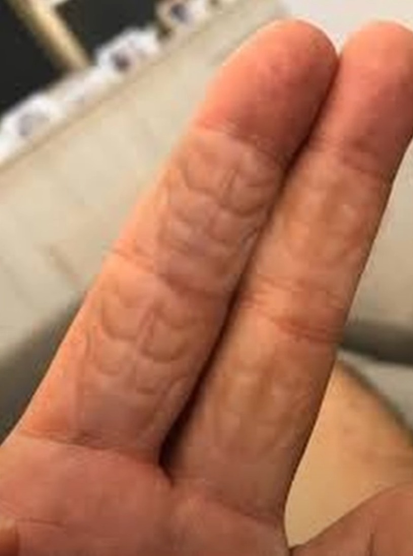 thumb