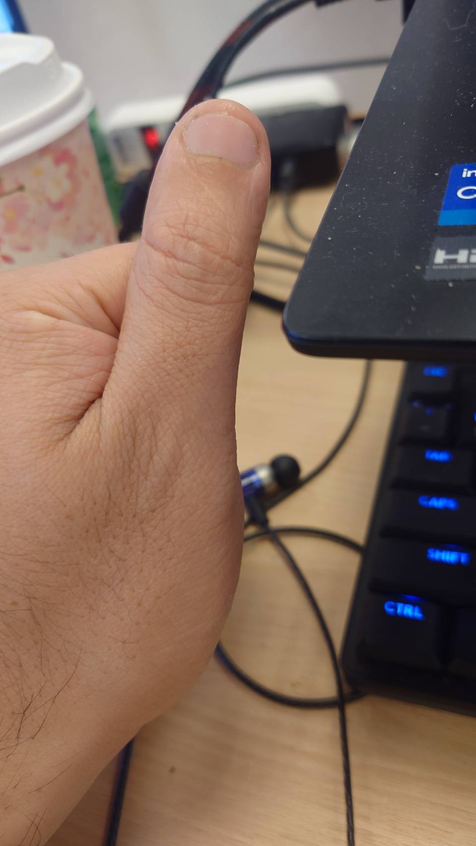 thumb