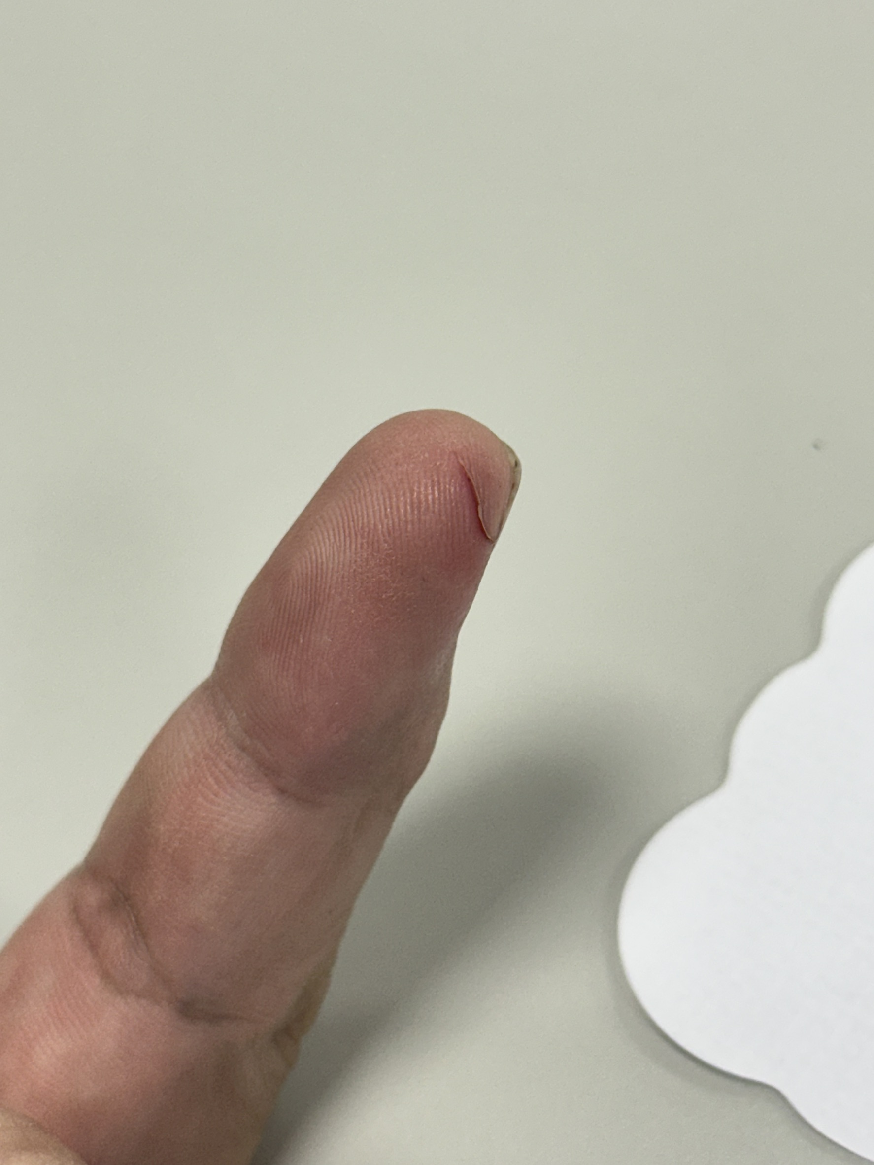 thumb