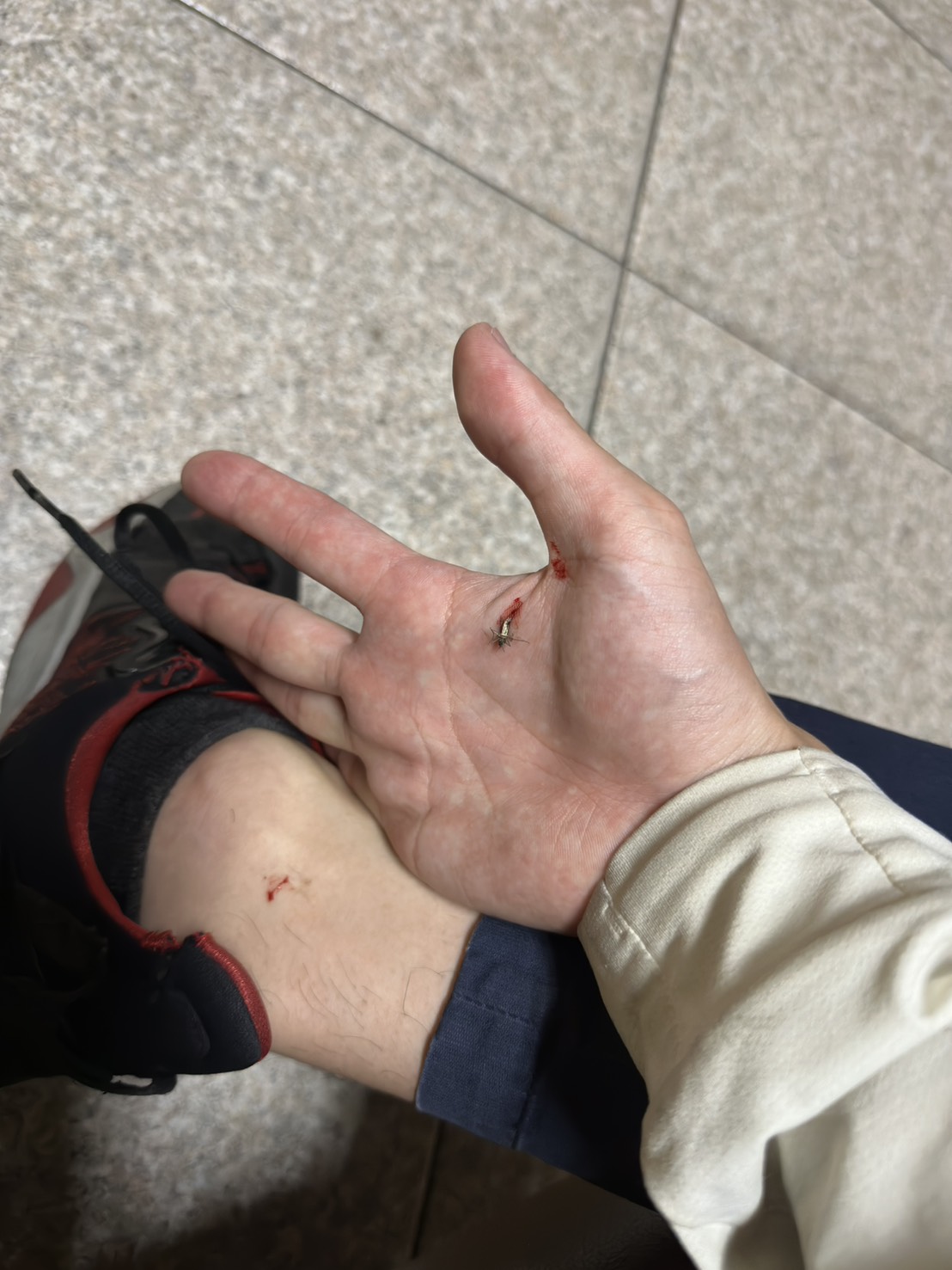 thumb
