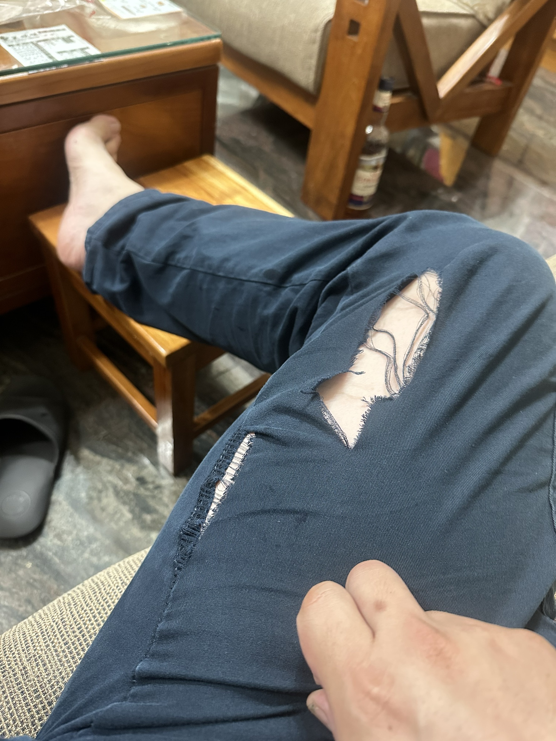 thumb
