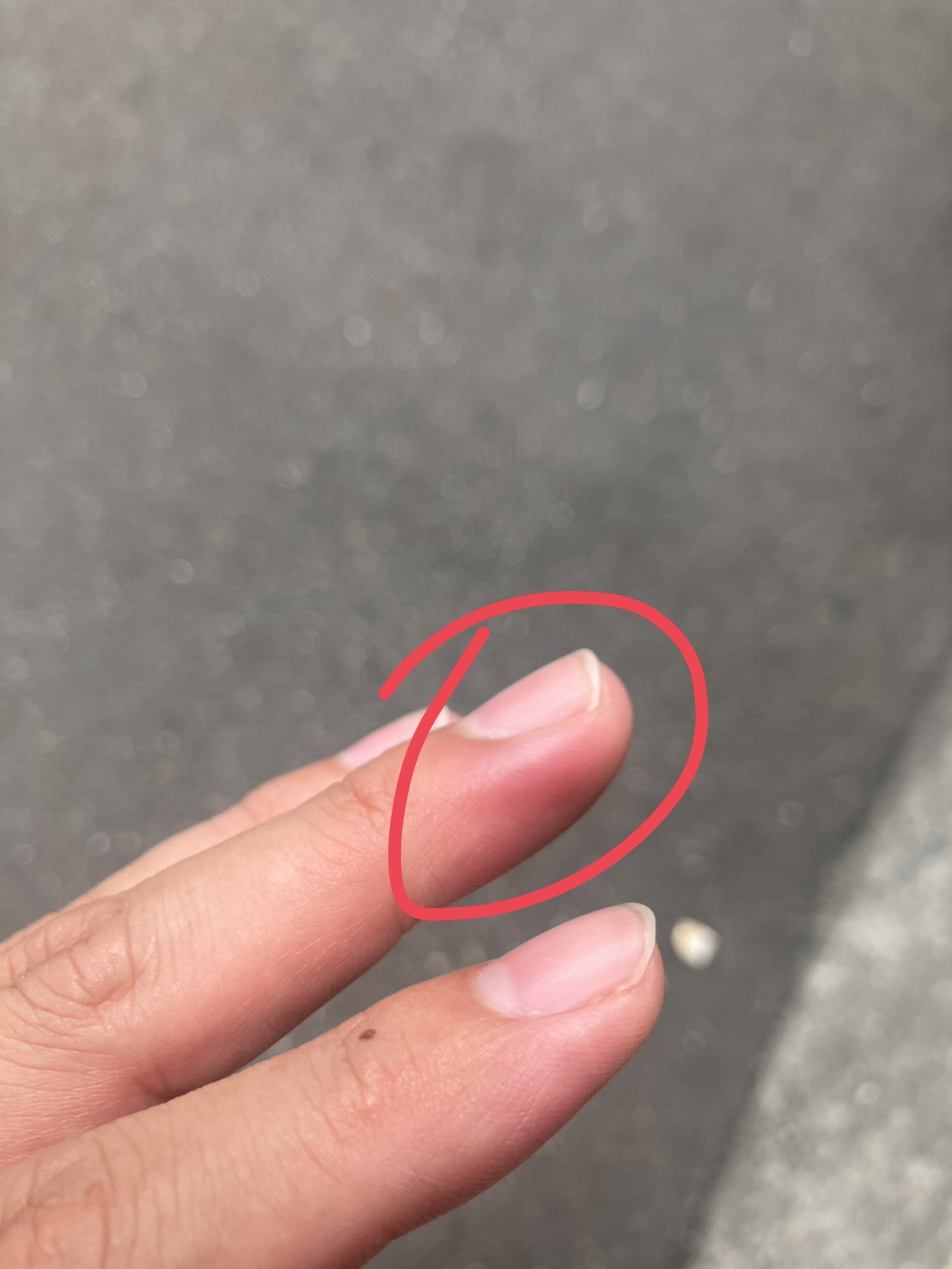 thumb