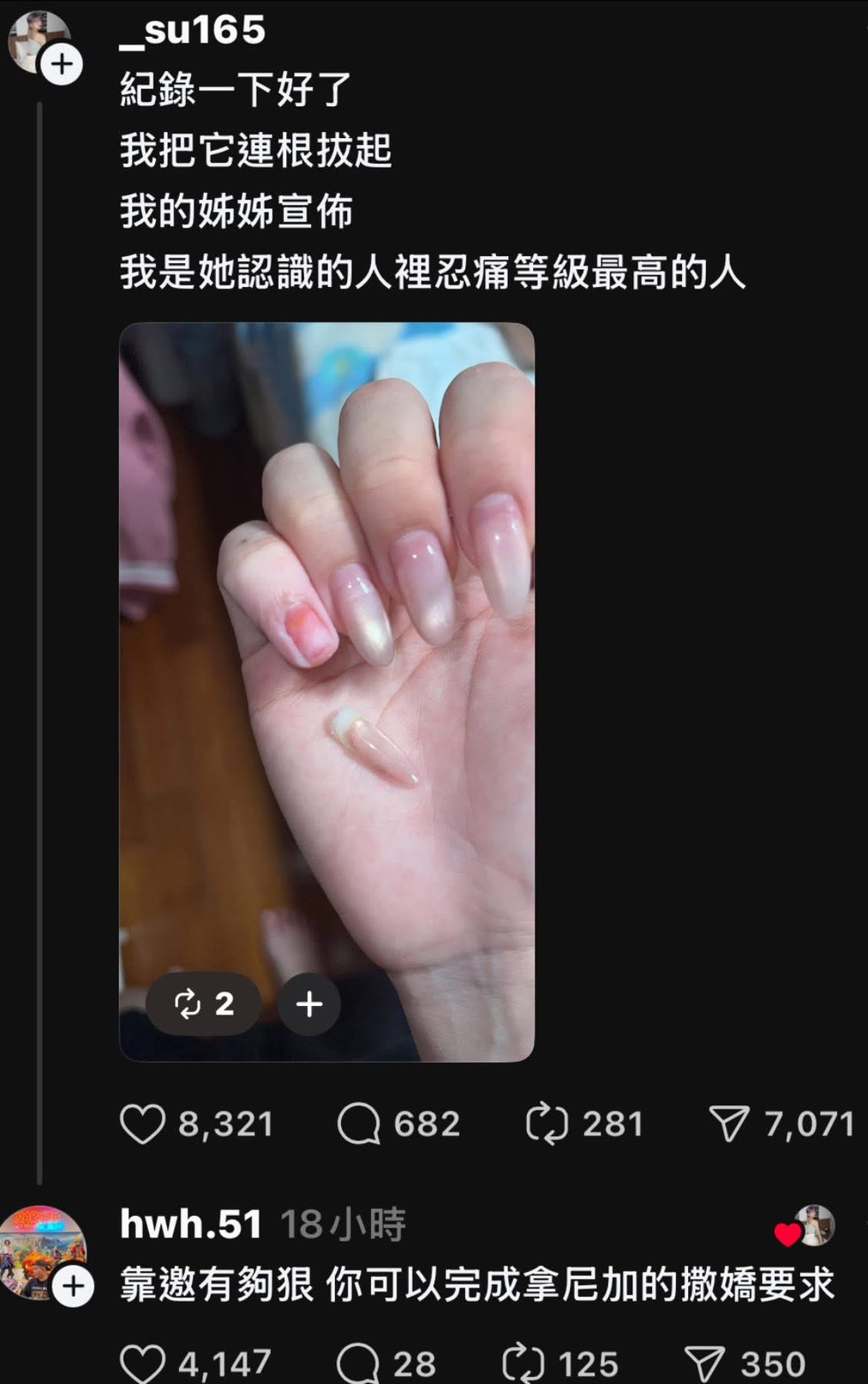 thumb