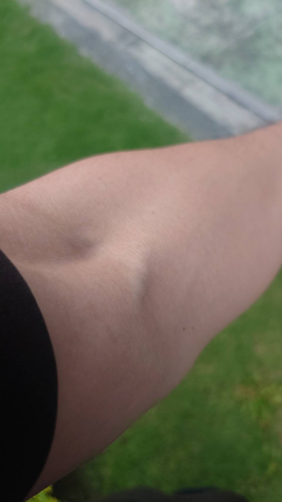 thumb